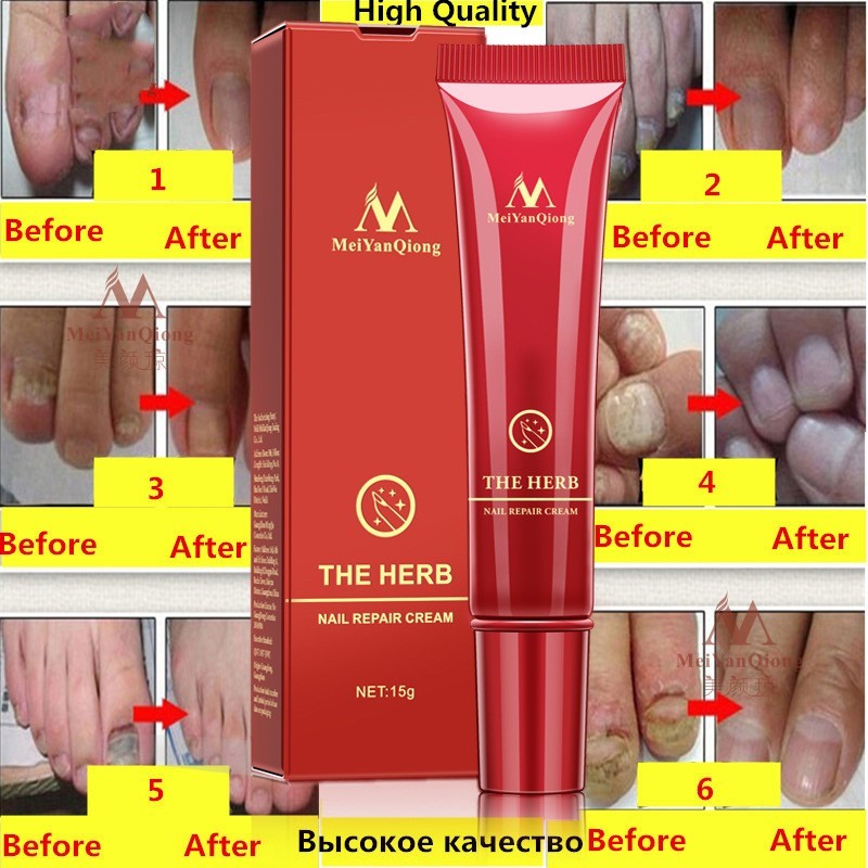 Beauty Hand And Foot Nail Repair Cream